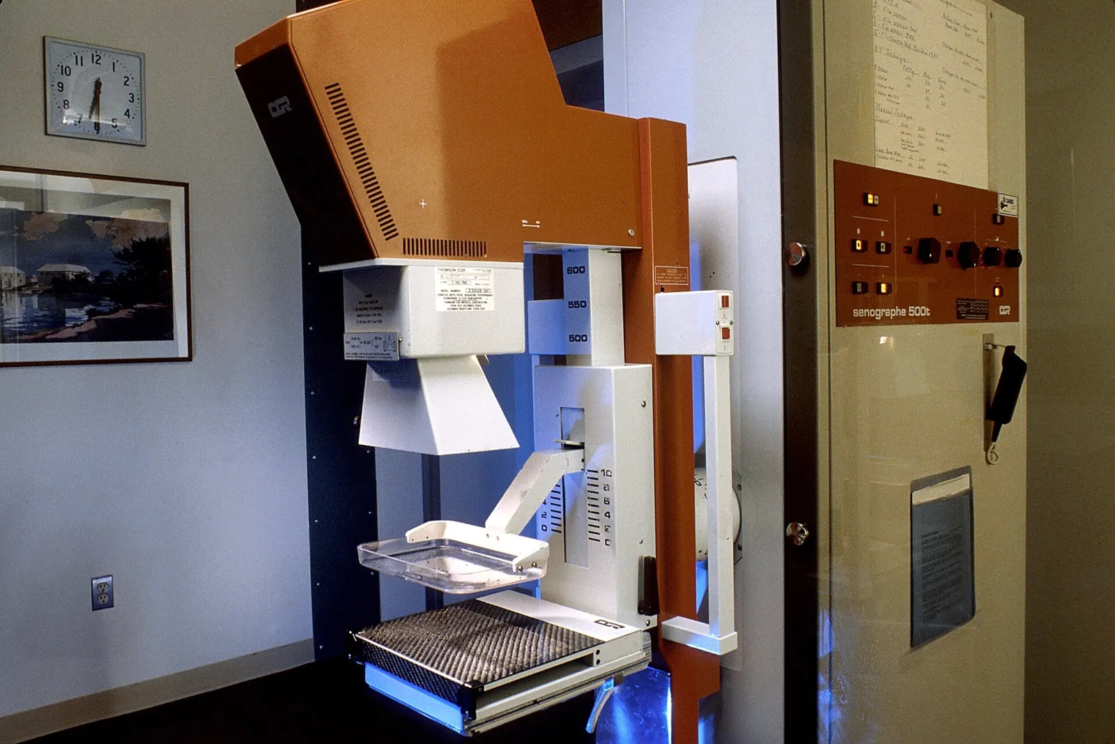 Mammography equipment photographed in January 1991. Illustrative archive; not a newly deployed device or the WHO training programme.