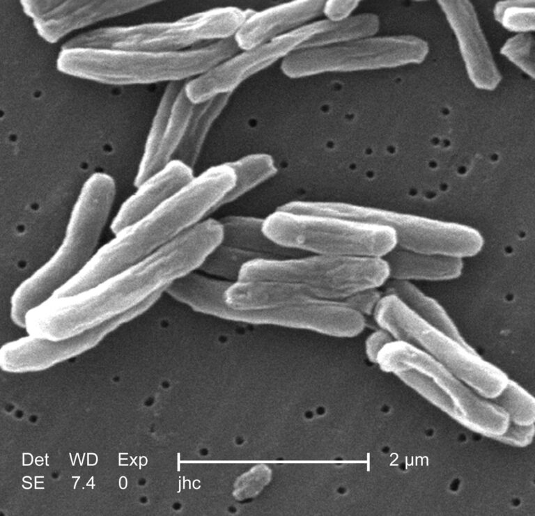 Сканираща електронна микрография на Mycobacterium tuberculosis, CDC, 2006 г. Научен архив; не показва ново лекарство или участник в клинично изпитване през 2026 г.
